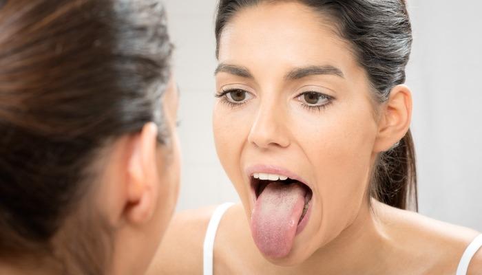 Ağzınız sinyal veriyor: Dilinizdeki bu renklere dikkat! Kanser veya diyabet belirtisi olabilir