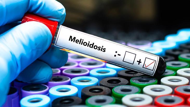 Avustralya'da melioidoz salgını! Can kaybı 31'e çıktı