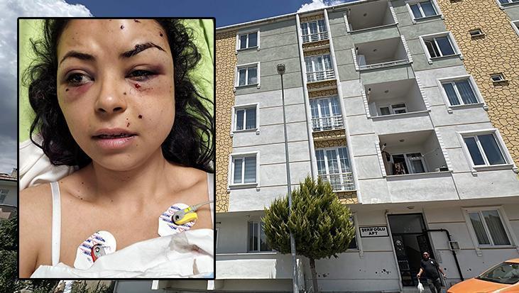 Düğünde tüfekli kavga: Pencereden izlerken, gözünden vuruldu