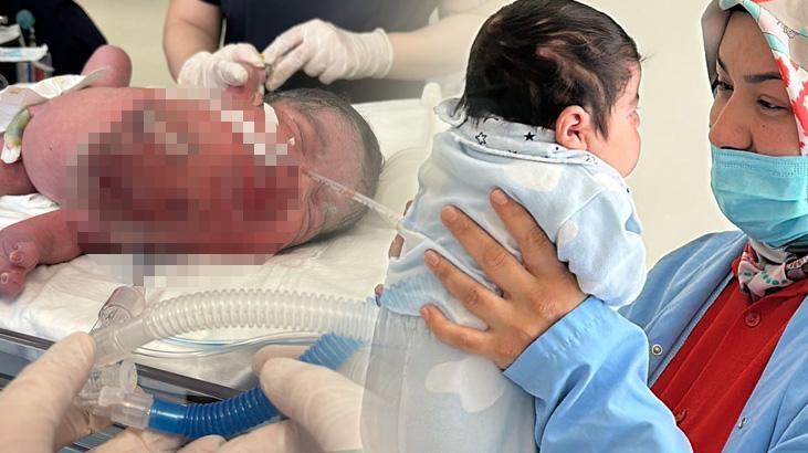 Eymen bebek dünyada 7'inci vaka olarak tarihe geçti: Yaşama şansı yoktu