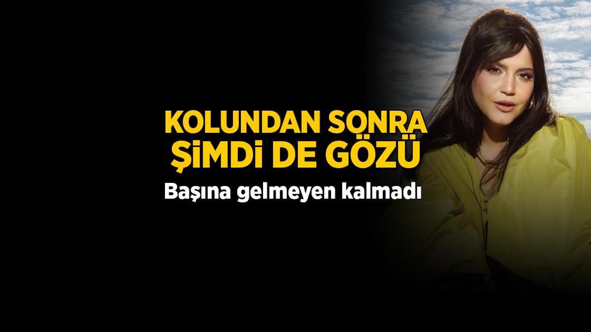 Feyza Civelek'in başına gelmeyen kalmadı! Kolundan sonra şimdi de gözü