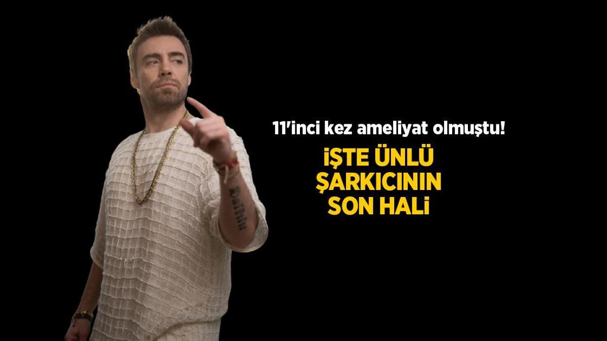 HABERLER: Murat Dalkılıç 11'inci kez burnundan ameliyat oldu! Son haline bakın