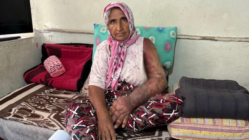 Her şey 8 yıl önce başladı! Kolu şişti, vücuduna kadar yayıldı