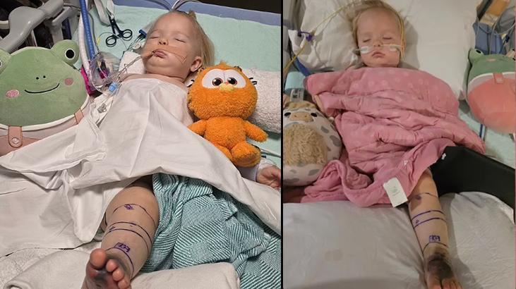 Mucize bebek! Çıngıraklı yılan tarafından iki kez ısırıldı, 30 şişeden fazla panzehir verildi