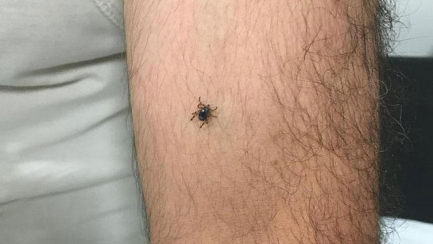 Panik büyüyor! Bir ilçede daha kene vakası görüldü