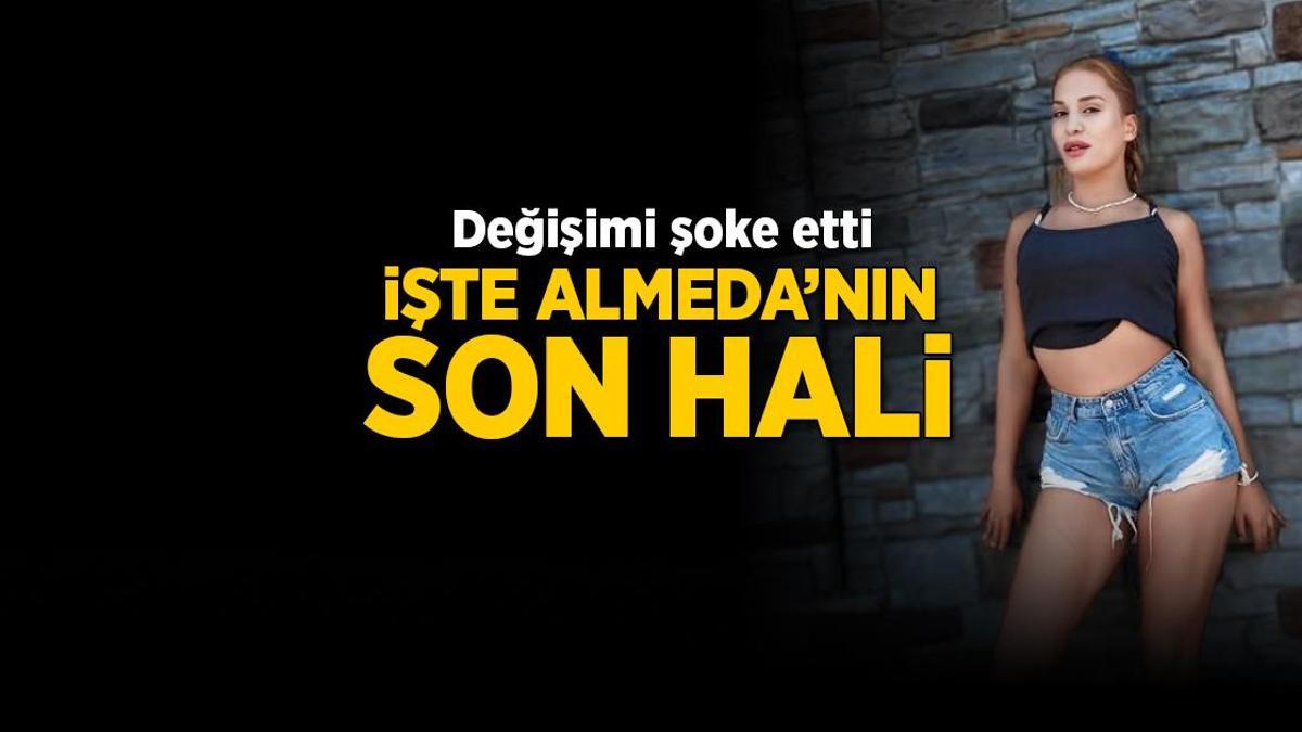 Survivor Almeda burun ameliyatı oldu! İşte Survivor Almeda'nın son hali
